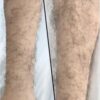 Arms Hair
