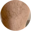 Legs Hair